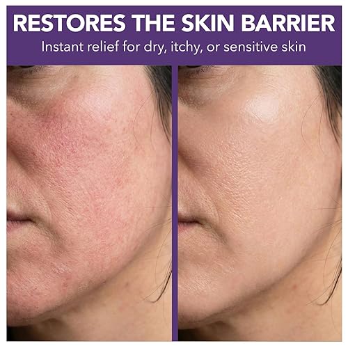 Miniatura 6 de Intimate Rose Sarga de ternera para el cuidado de la piel y la cara, bálsamo de miel para pieles sensibles, eccema, hidratante facial 100%