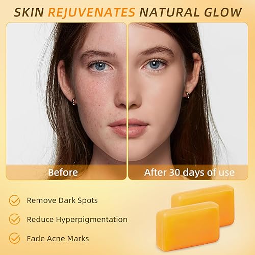 Miniatura 2 de Jabón de ácido kójico, jabón de cúrcuma para manchas oscuras con colágeno, vitamina E, retinol, ácido hialurónico, manteca de karité, barra de jabón