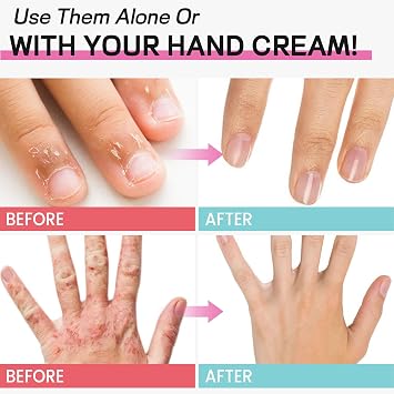 Moisturizing Gel Glovers,Touchscreen Silicone Moisturizing Gloves,Softening Dry Cracked Hand Skins with Essential Oils and Vitamins.