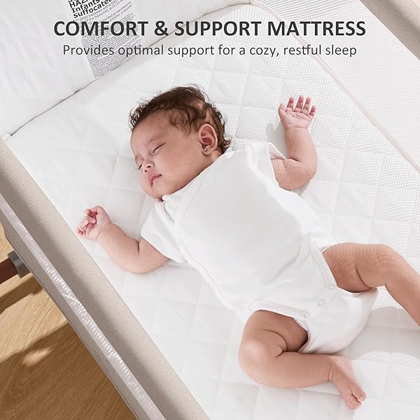 3-in-1 Baby Bassinet with Rocking Motion 4