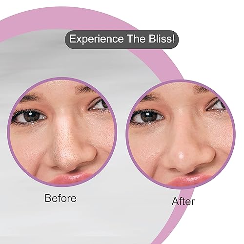 Miniatura 6 de DR.RASHEL Tiras de poros de nariz de carbón para limpieza de poros, eliminación instantánea e indolora de puntos negros  Tiras eliminadoras de