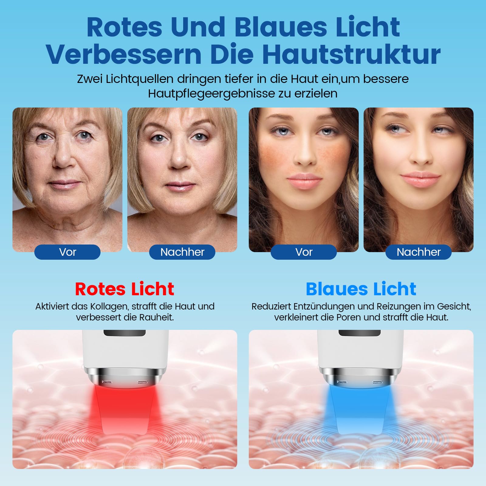 Skin Scrubber a ultrasuoni, pulitore per pori, elettrico con 4 modalità e luce rossa, luce blu, dispositivo ad ultrasuoni, dispositivo ad ultrasuoni per la pulizia del viso (bianco)