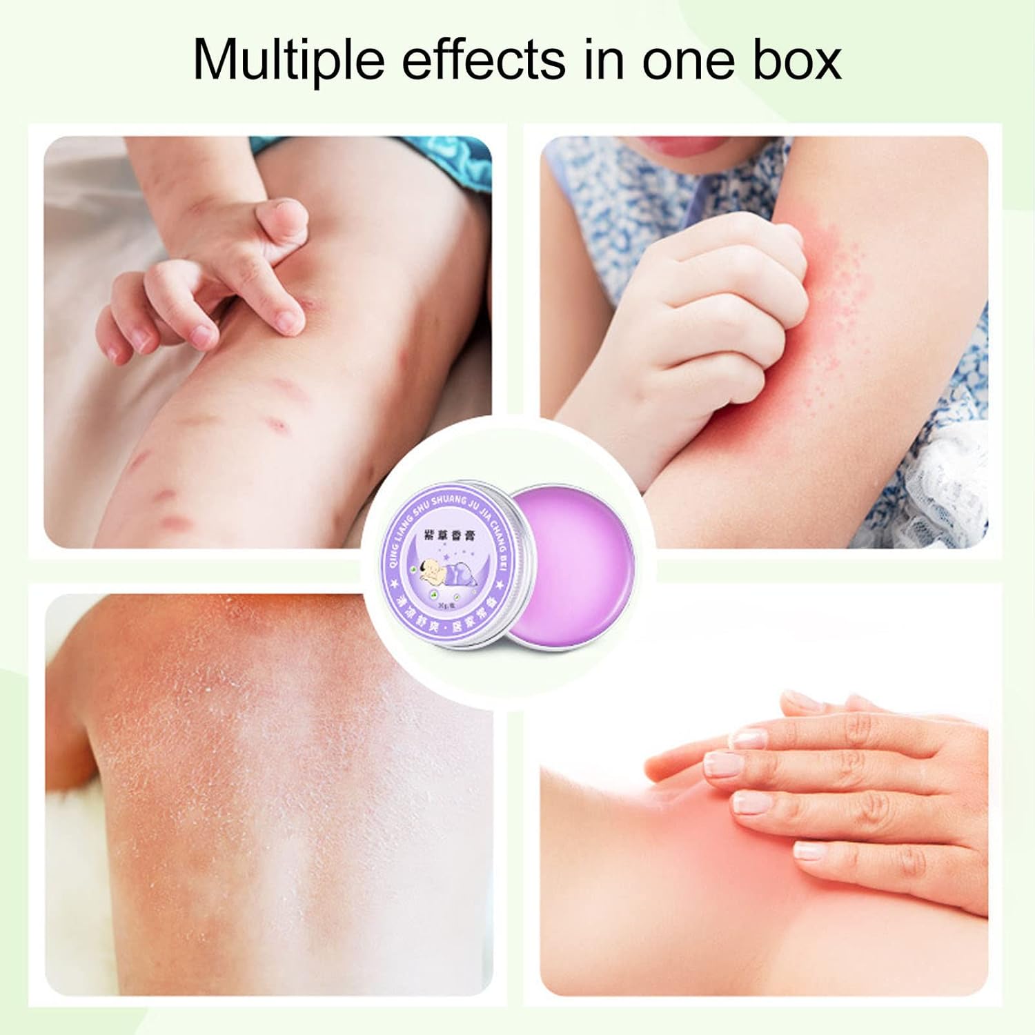 Mosquito Bite Cream,Itch Relief Cream Bite and Sting Relief Cream Bite