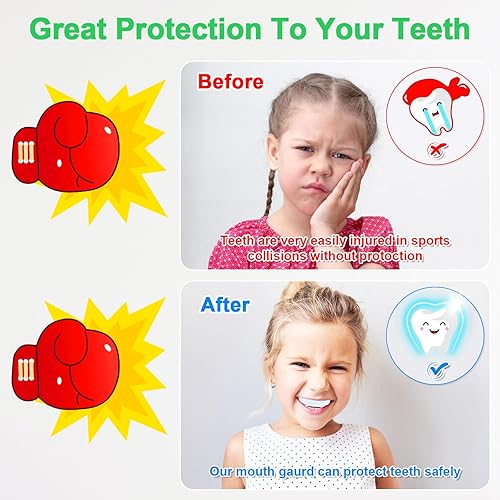 Miniatura 4 de MENOLY Paquete de 5 protectores bucales para niños y jóvenes, sin BPA, para niños y niñas, con funda portátil, protector bucal para boxeo,