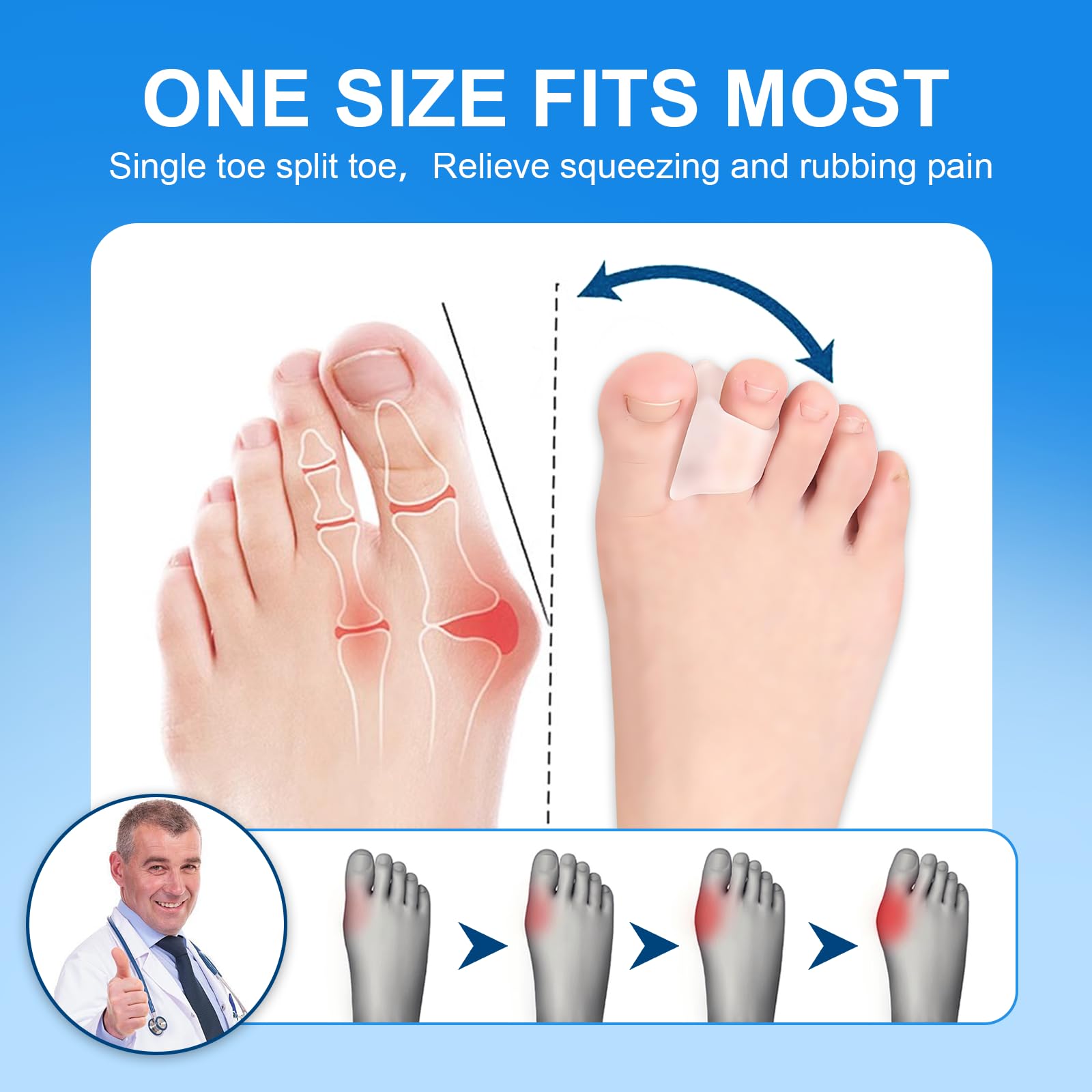 3 Diverse Dimensioni Correttore per Dita dei Piedi a Martello,Toe Splints Realign Bent, Si Adatta Alle Dita dei Piedi Senza Cadere,Hammertoe Corrector per Donne e Uomini,Morbido(Trasparente)