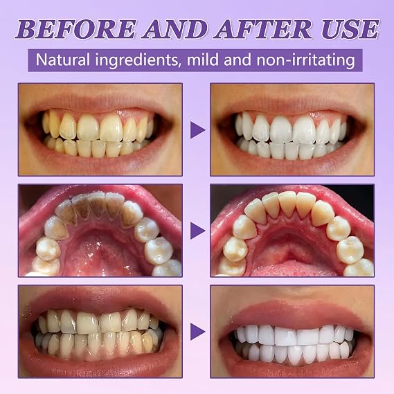 Teeth Restoration Mineral Powder, 50g Dental Restoration Mineral Powder, Natural Tooth Whitening Essence, Effective in Strengthening Teeth and Gums, Freshen Breath