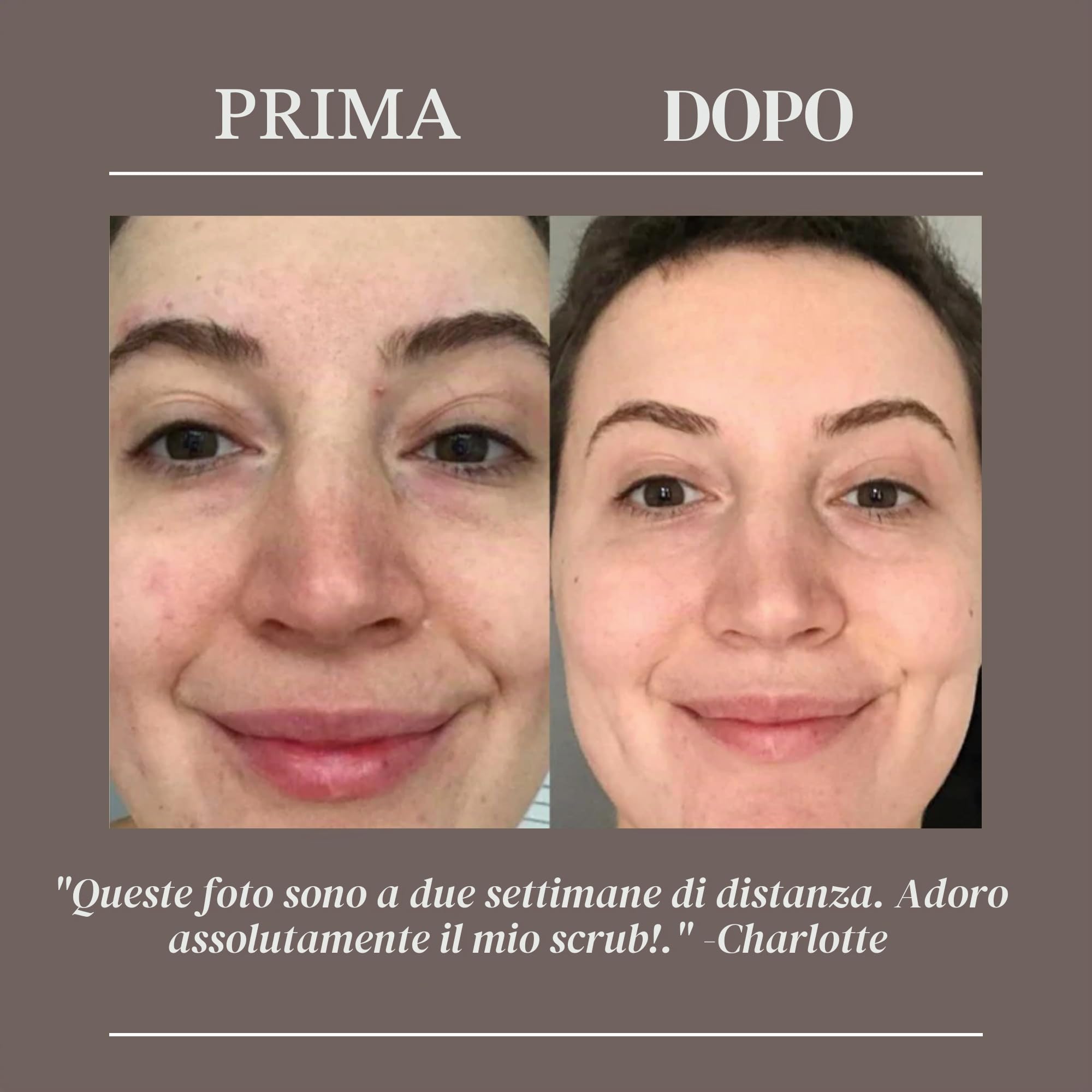 UpCircle Scrub viso al caffè - Miscela di agrumi per pelli normali e secche 100 ml - Burro di karité, cocco e olio di rosa canina - Esfoliante viso naturale e vegano per una pelle morbida e liscia