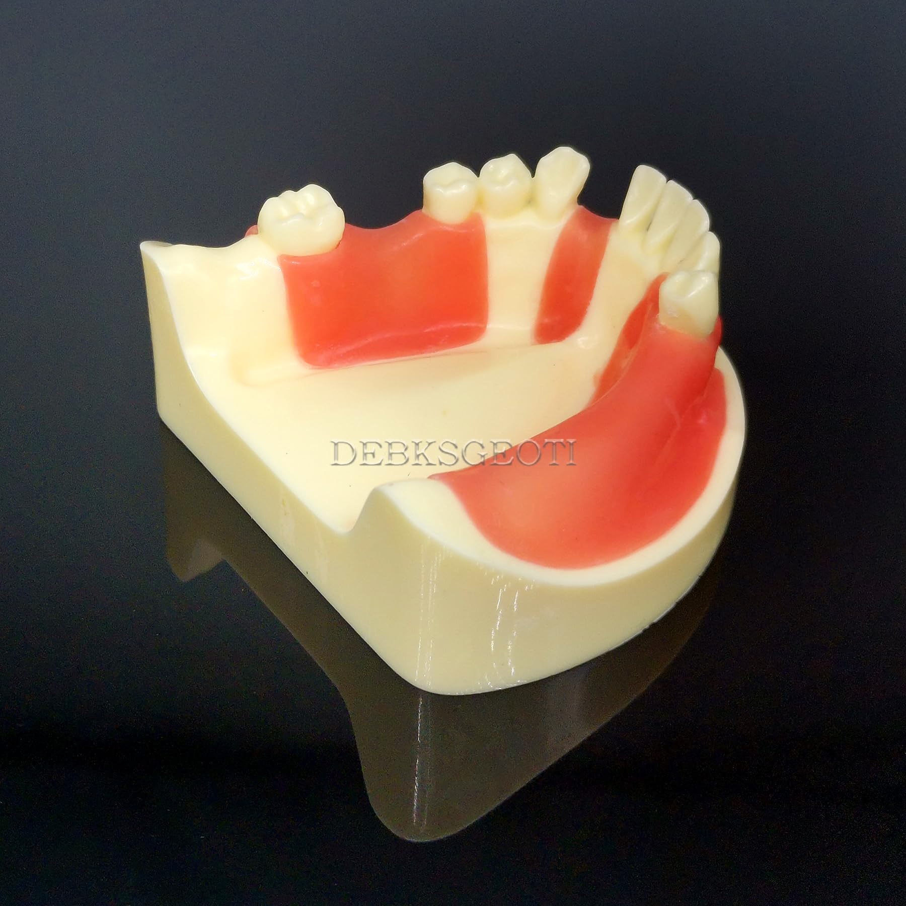 Dental Lower Jaw Implant Practice Model (M2004) With Removable Gingiva & Teeth