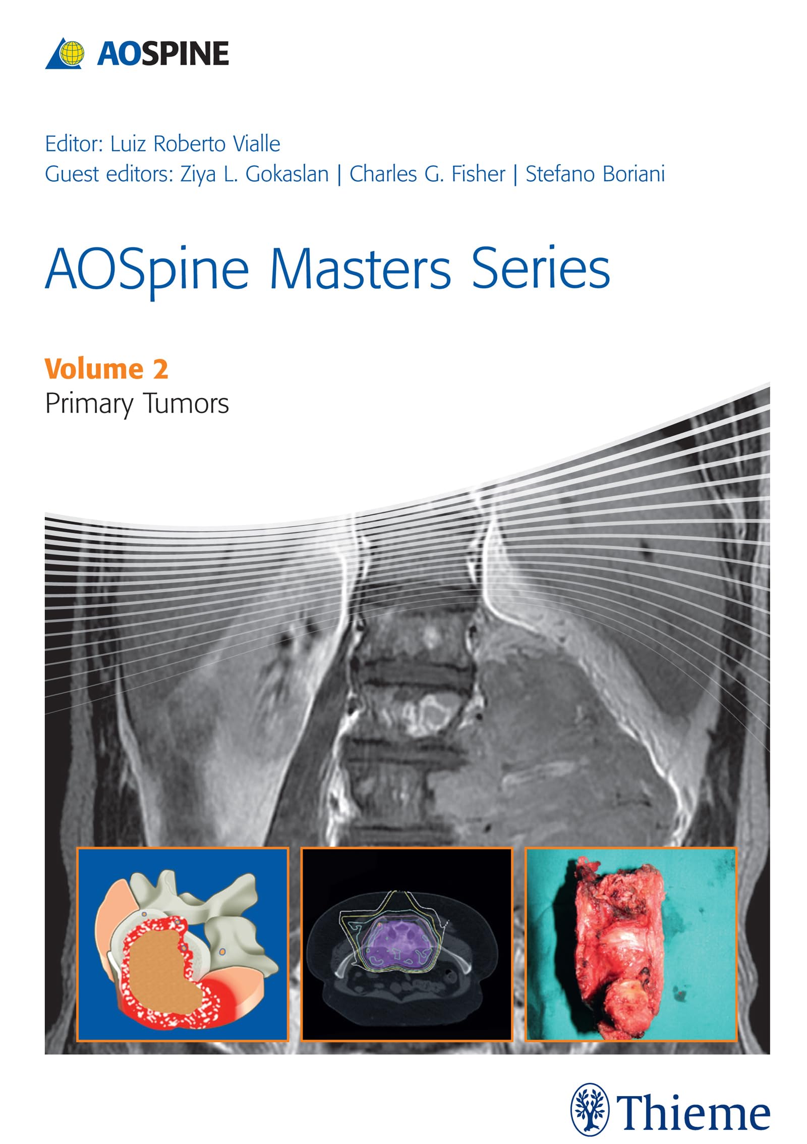 Buy Aospine Masters Series Primary Spinal Tumors Vol 2 (Hb 2015) — BookShops.in