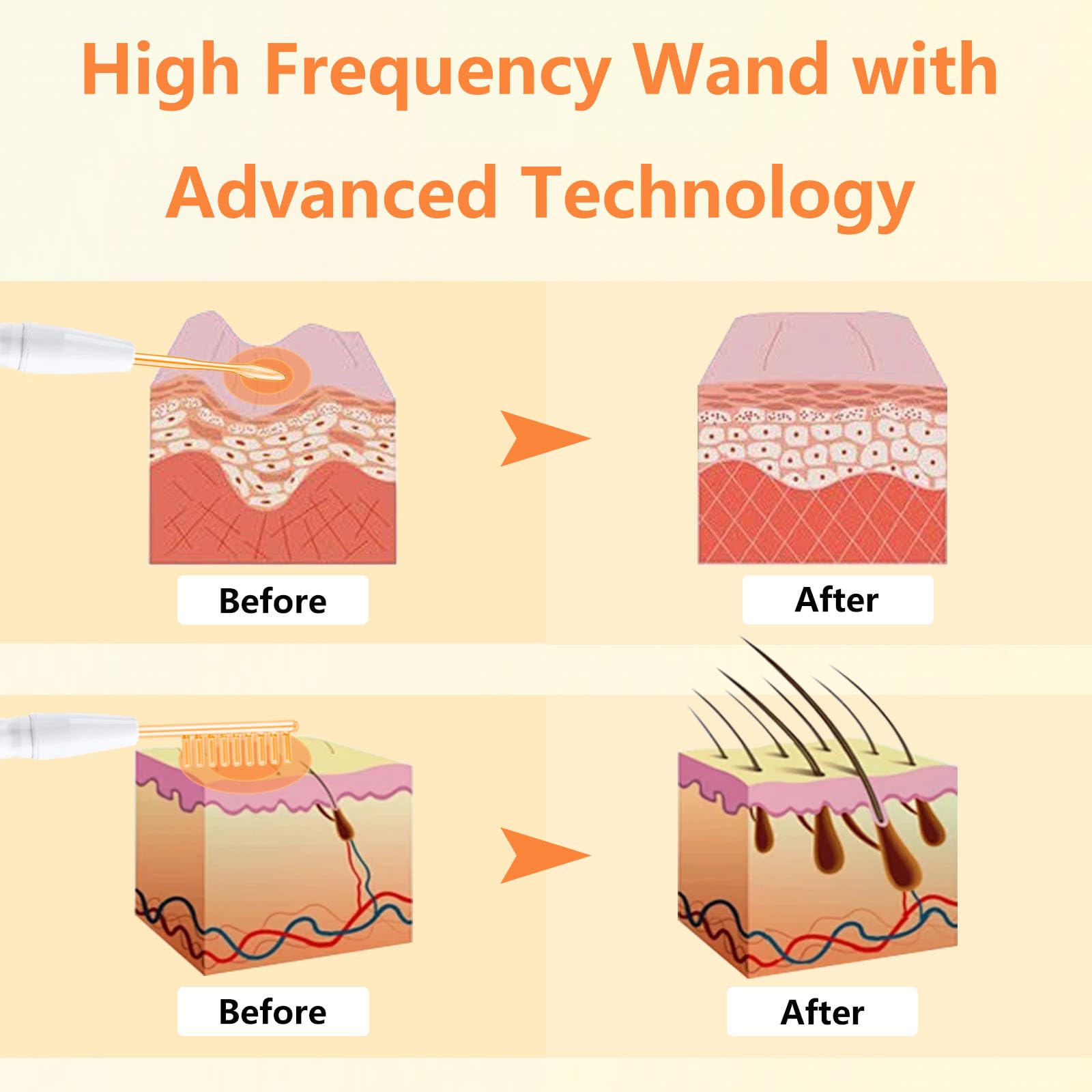 Varita facial de alta frecuencia F para el cuidado facial, máquina multifunción para dispositivos faciales