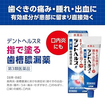 Amazon | 【第3類医薬品】デントヘルスR 40g | デントヘルス | 歯槽膿 Amazon | 【第3類医薬品】デントヘルスR 40g | デントヘルス | 歯槽膿