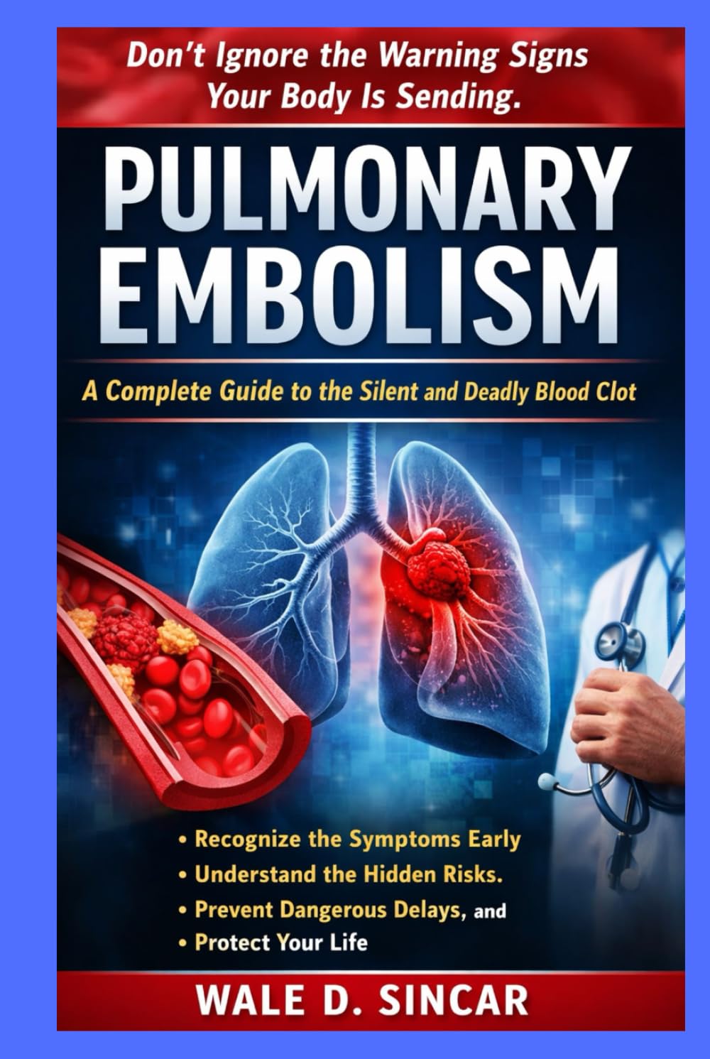 "PULMONARY EMBOLISM: A COMPLETE GUIDE TO THE SILENT AND DEADLY BLOOD CLOT": Recognize the Symptoms Early, Understand the Hidden Risks, Prevent Dangerous Delays, and Protect Your Life