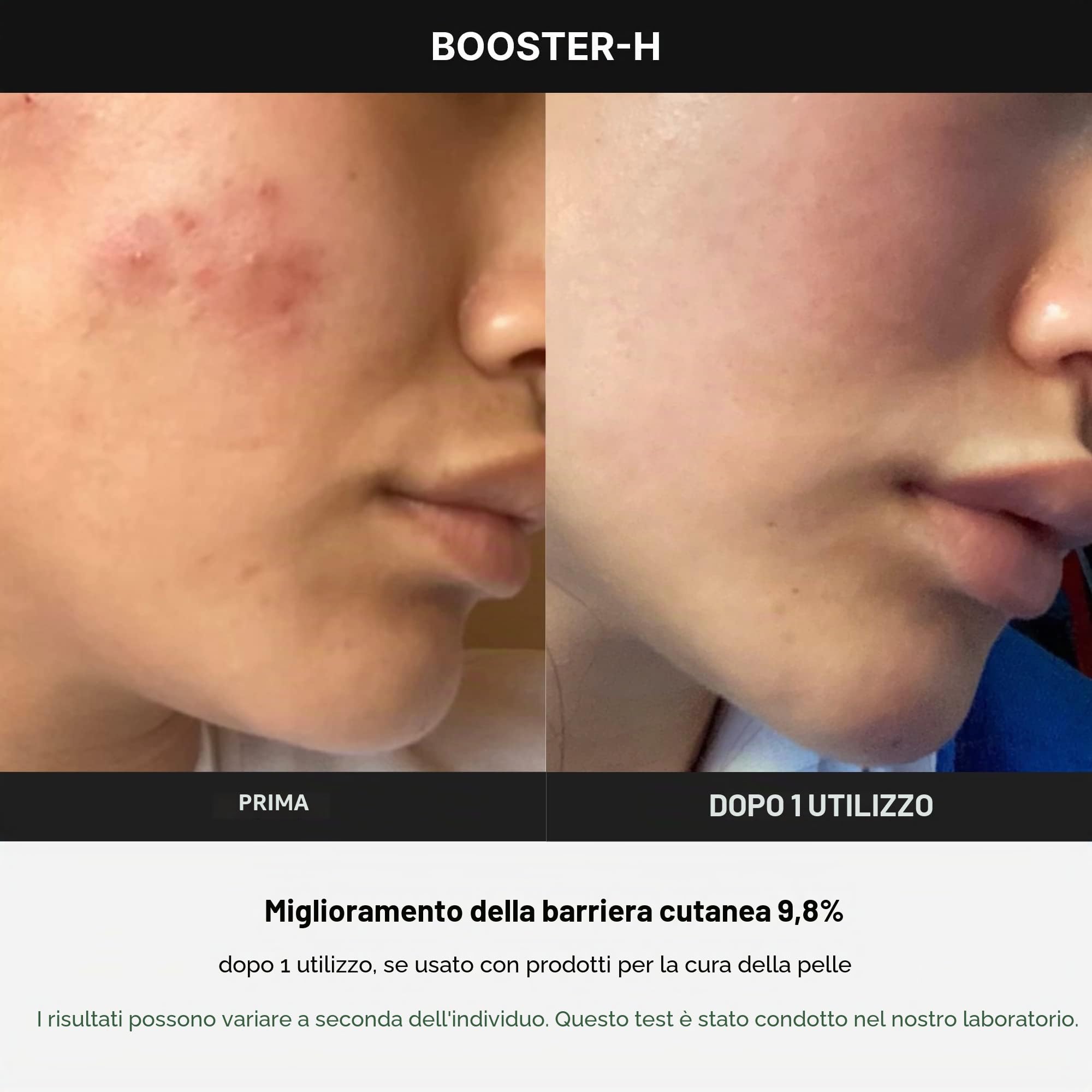 Medicube Age-R Booster H - Dispositivo coreano No.1 per la cura della pelle, booster luminosità facciale senza aghi