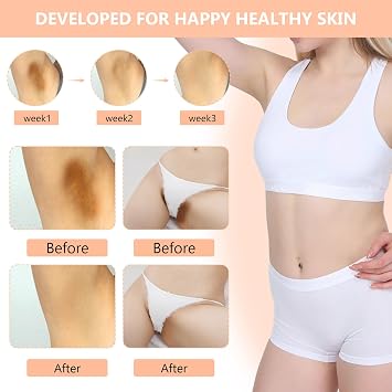 Skin Bleaching Cream for Body-Dark Spots Remover Lightening Cream & Uneven Tone Nourishing Formula Bleaching Intimate Areas & Underarms Inner Thigh, Bikini Line, Armpit Knees Elbows for All Skin Types