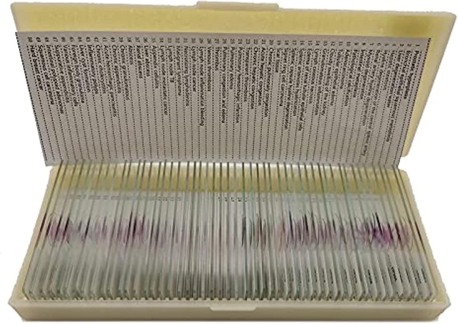 50pcs Hum Patológica Portaobjetos De Microscopio con Muestras, Secciones Patológicas Médicas Portaobjetos De Microscopio, Portaobjetos De Histología para Educación De Estudios Médicos