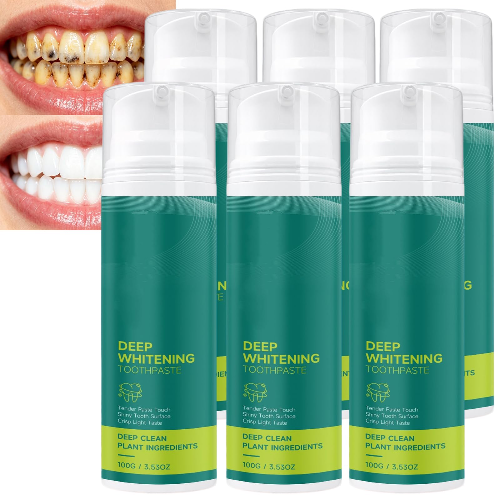 Dentifrice blanchissant nano hydroxyapatite, dentifrice ultra blanc anti-taches en profondeur, dentifric/e doux pour les dents sensibles, dentifri/ce de soins bucco-dentaires sans émail (6pcs)
