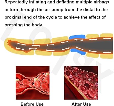 Pressotherapy and Lymphatic Drainage, Electric Legs Air Compression Massager, Waist Arm Leg Foot Massage Relax Blood Circulation