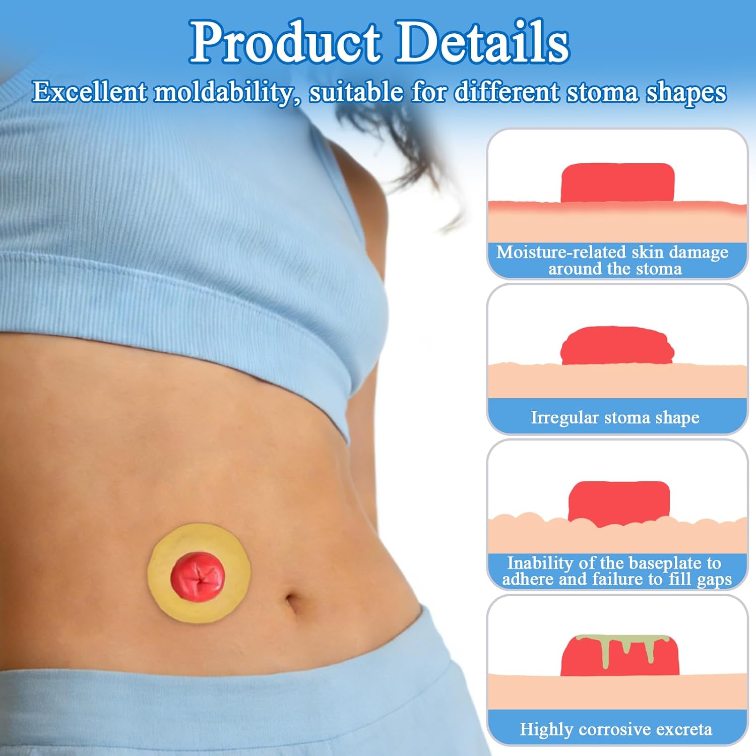 QCWN 20PCS Ostomy Barrier Rings 50mm 2mm Thickness Moldable Stoma Sealing Ring Hydrocolloid Skin Extender for Colostomy Bags Leak Free Ostomy Supplies