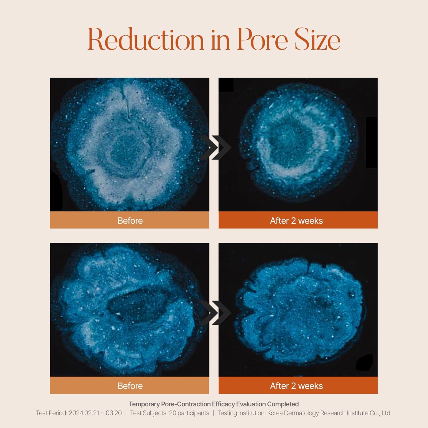 shaishaishai CAFFEINE SHOT Blemish Toning Serum, 10% Niacinamide & 5% Caffeine for Hyperpigmentation, Even Skin Tone, Reduced Pore Size and Puffiness, Pigmentation Care, Korean Skin Care, 1.01 Fl Oz - Image 8