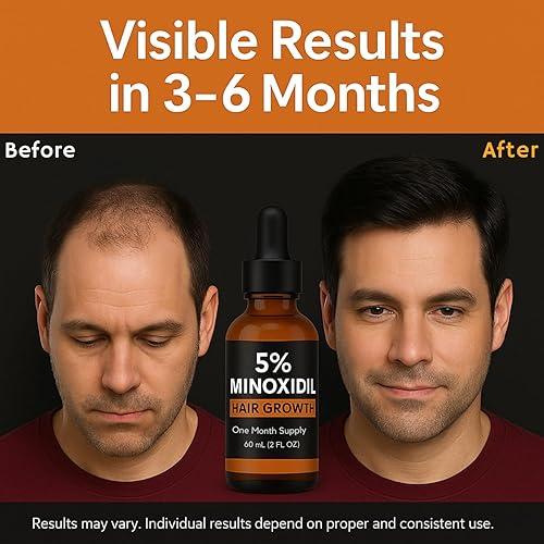 Miniatura 4 de Minoxidil para hombres Solución tópica al 5%  Tratamiento de crecimiento de barba y cabello, fórmula extra fuerte para la pérdida de cabello para