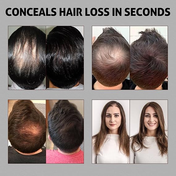 Ustar 4 in 1 Hair Building Fibers Set for Thinning Hair Thickening Natural Hair Loss Concealer Powder for Men & Women Bald Spot Cover Up and Hair Volume Enhancer 27.5g Black