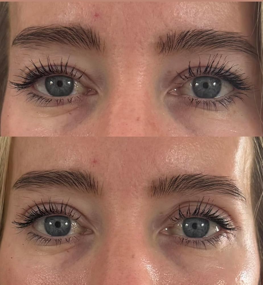 Lids by Design Eyelid Lift Strips - Non-Surgical Eye Lift (80 Strips)