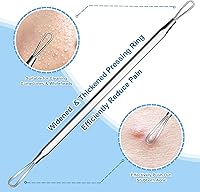 Vista 3 de Stainless Steel Blackhead Remover, Pimple Extractor, Pimple Popper, Comedone Extractor, Surgical Grade Acne Treatment Tool, 3rd Generation Blemish