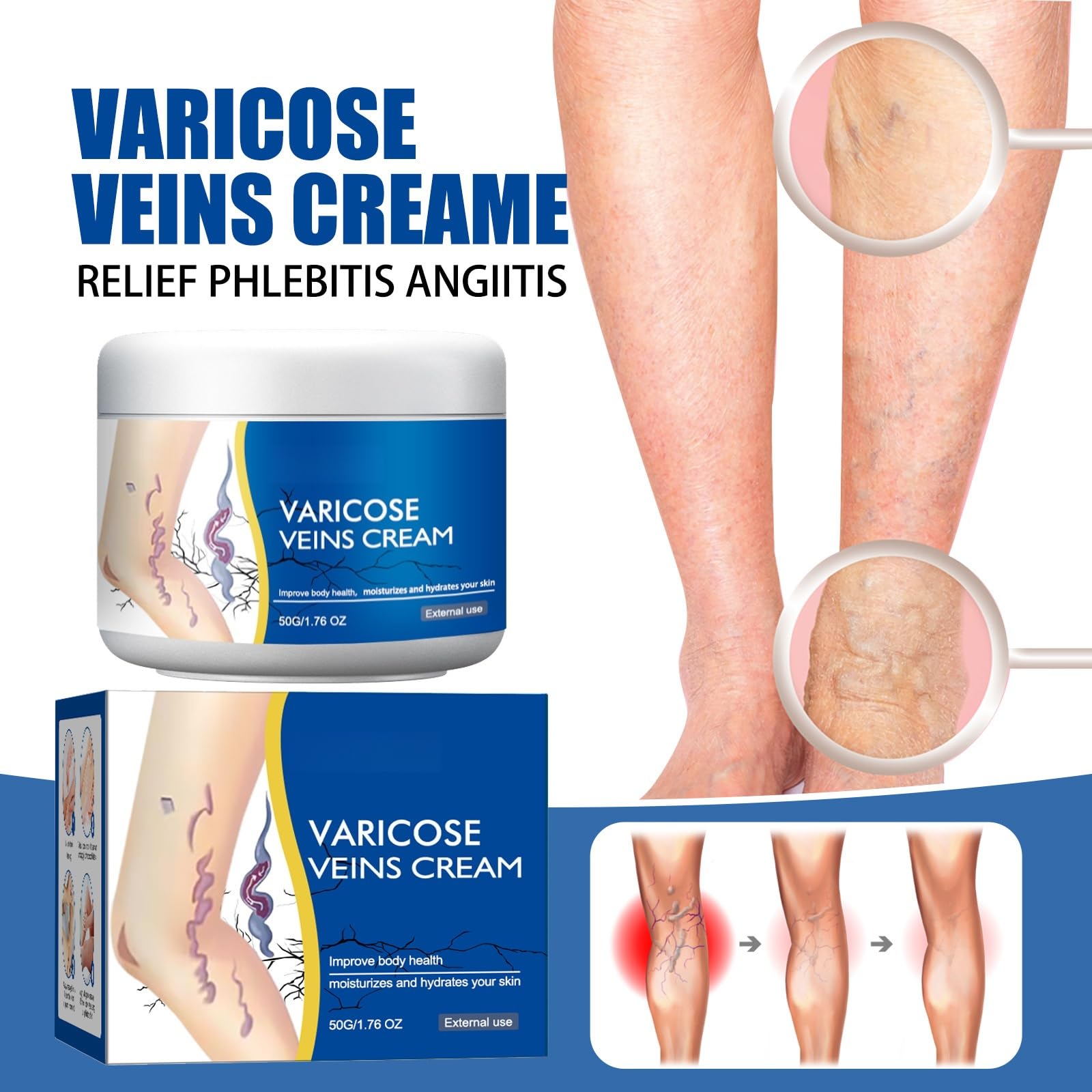 Crema per Vene Varicose,Crema per Vene Varicose Gambe,Cremas Lenitiva per Gambe,Cremas Trattamento Delle Venes Varicoses,50G