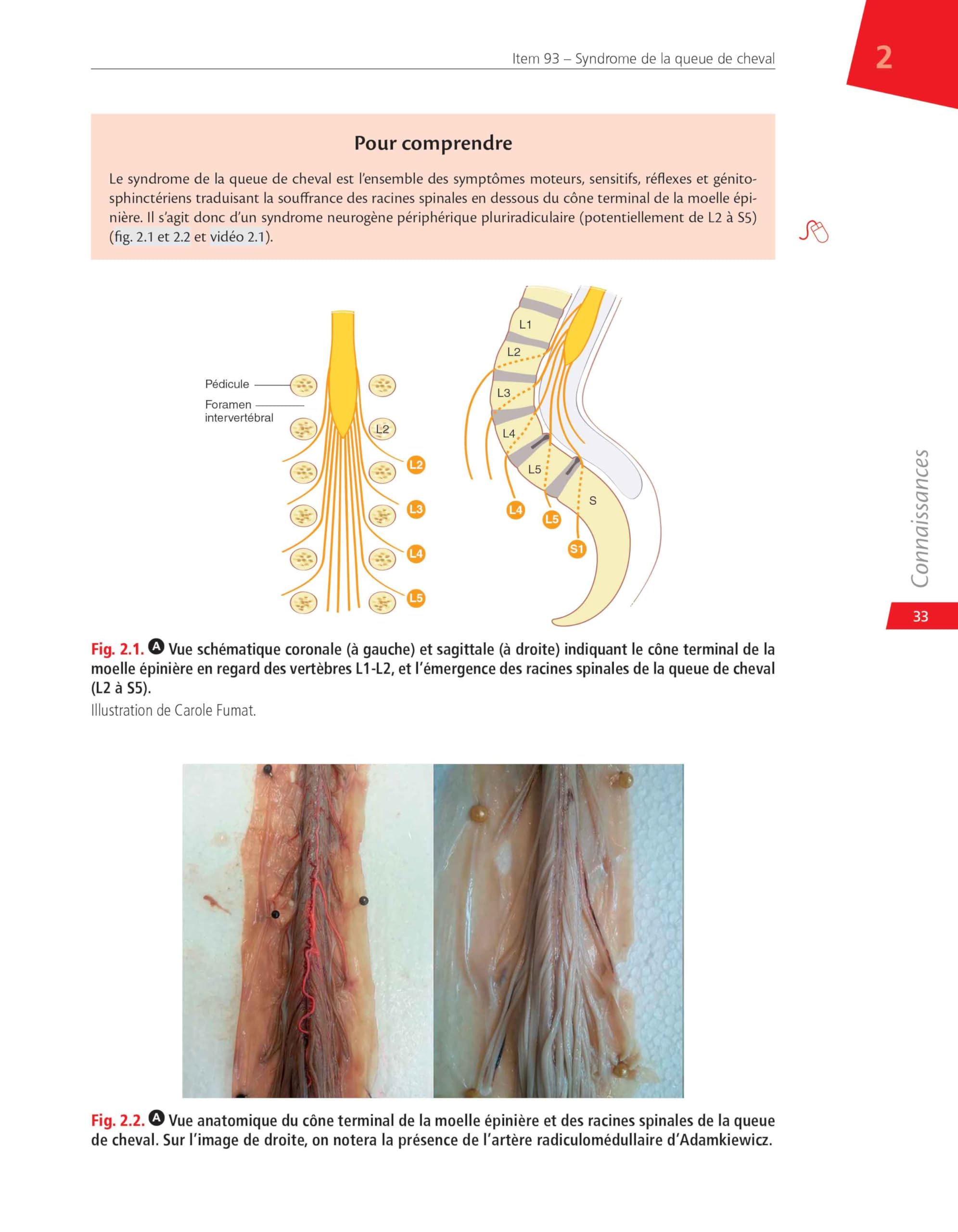 Neurochirurgie: Réussir ses EDN