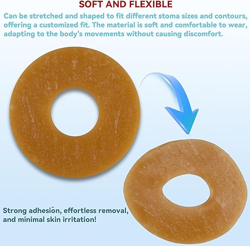 Miniatura 3 de 30 anillos de barrera de ostomía adaptables, extensores de piel hidrocoloides moldeables delgados de 0.079 pulgadas para un mejor sellado y barrera