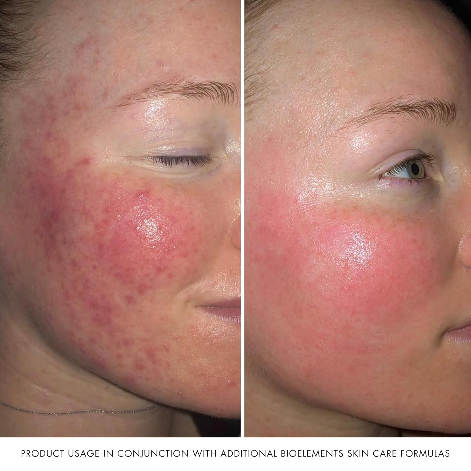 Bioelements Barrier Fix Daily Hydrator - 1.7 fl oz - Clinical Face Moisturizer - Target Irritation & Strengthen Sensitive, Dry Skin - Vegan, Gluten Free - Never Tested on Animals - Image 6