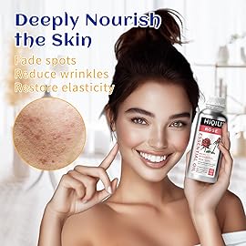 HIQILI 32 Fl Oz Rose Essential Oil, Huge Value Size Undiluted Rose Oil for Face, Skin, Diffuser, Hair