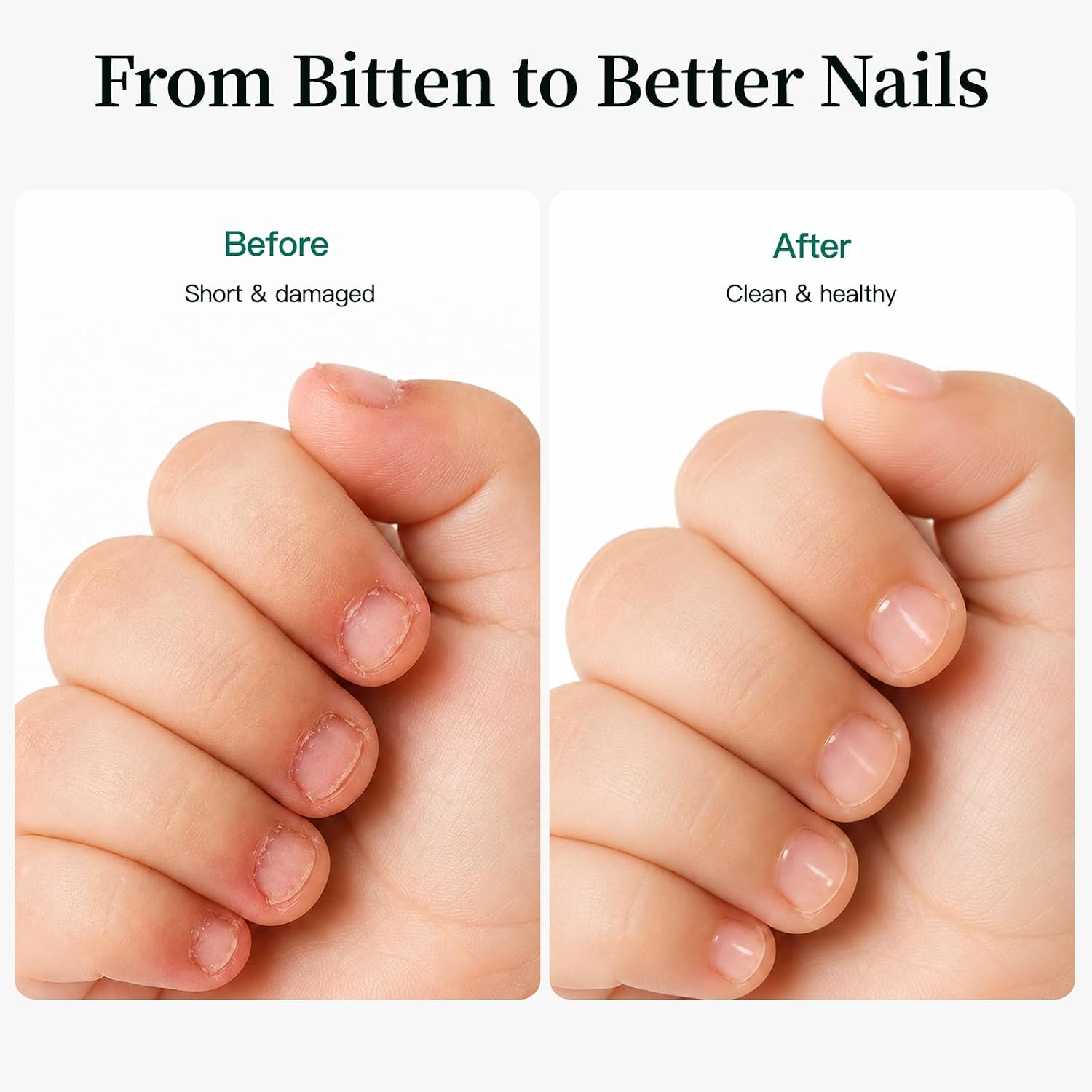 APUREE Nail Biting Prevention For Kids: 26-Free Safe Thumb Sucking Deterrent| Extra Bitter Only When Bitten |No Bite Nail Care with Pro-Vitamin B5|Stop Nail Biting with 28-Day Habit Tracker |2 Pcs