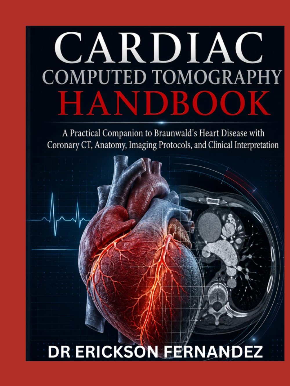 CARDIAC COMPUTED TOMOGRAPHY HANDBOOK: A Practical Companion to Braunwald's Heart Disease with Coronary CT, Anatomy, Imaging Protocols, and Clinical Interpretation