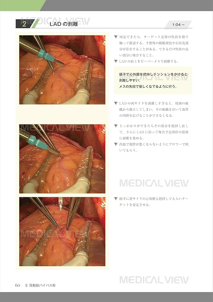 71GCKKzEBLL._AC_UF1000,