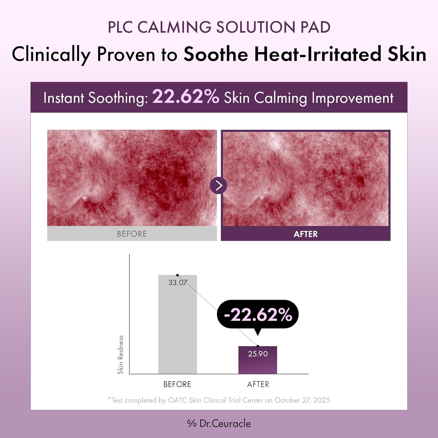 Dr.Ceuracle PLC Calming Solution Pad - Instant Calming and Soothing Toner Pad for Sensitive Skin, Korean Post Laser Skincare (130 Pads) - Image 3