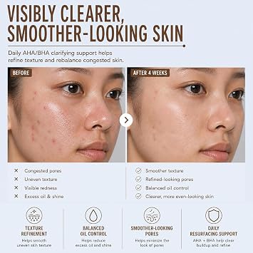 Pixi Beauty Clarity Tonic, AHA & BHA Toner | Minimize Pores, Promote A Clearer, Healthier Complexion, 250 ml