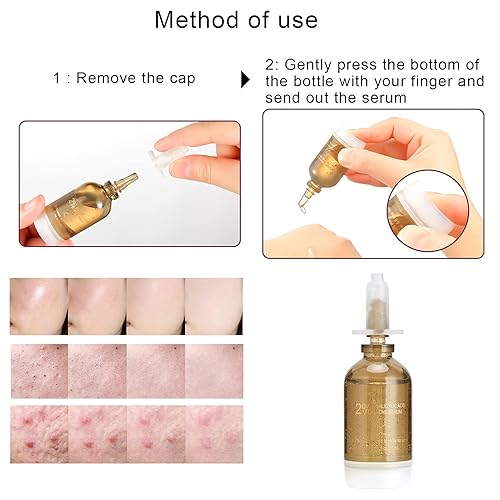 Miniatura 7 de Suero de ácido salicílico, tratamiento del acné para la eliminación de cicatrices de acné facial exfoliante facial tratamiento del acné suero facial