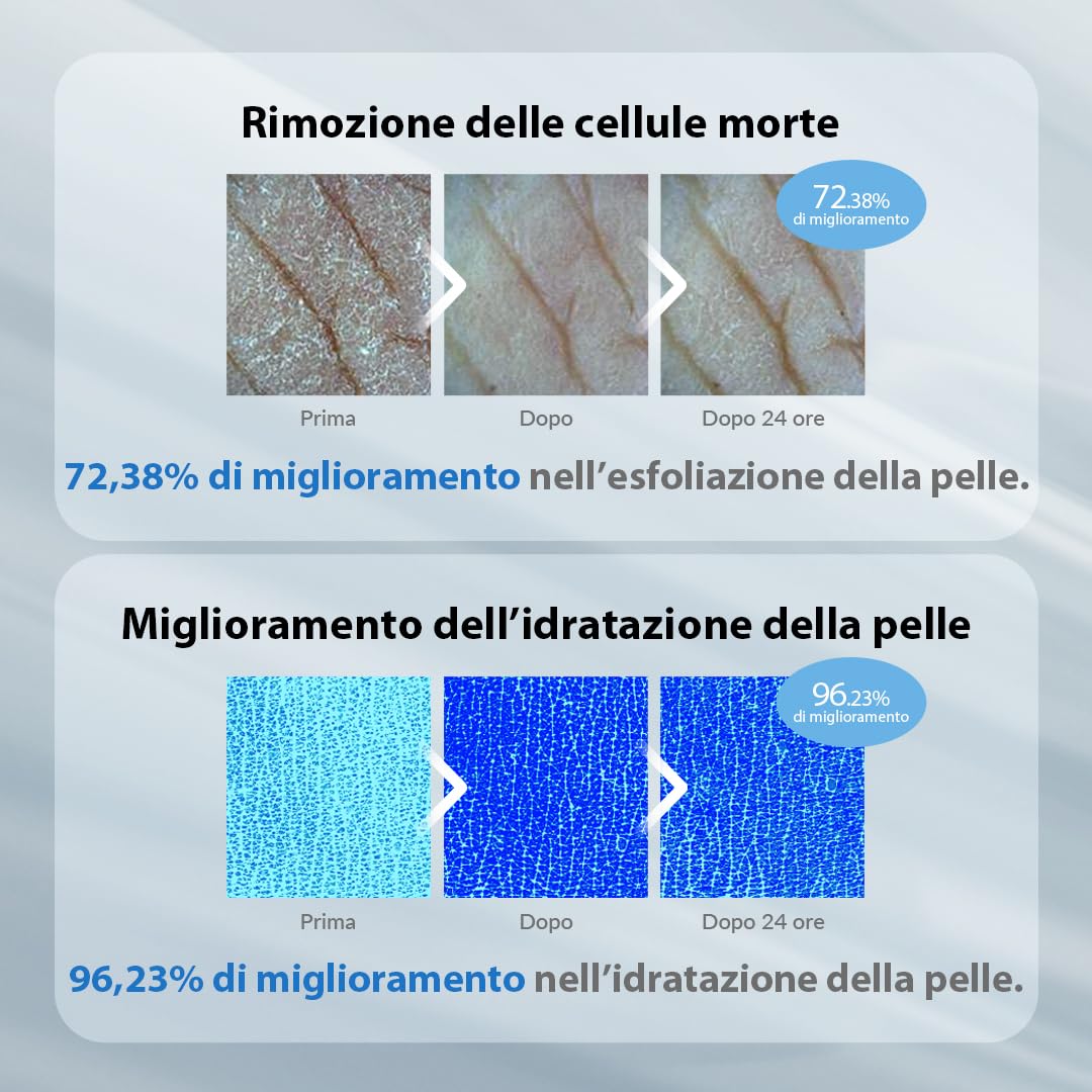 VILLAGE 11 FACTORY lozione per il corpo con acido glicolico AHA 12% (300 g), peeling e ringiovanimento, rimozione delicata delle cellule morte, senza profumo, senza parabeni (AHA Body Lotion)