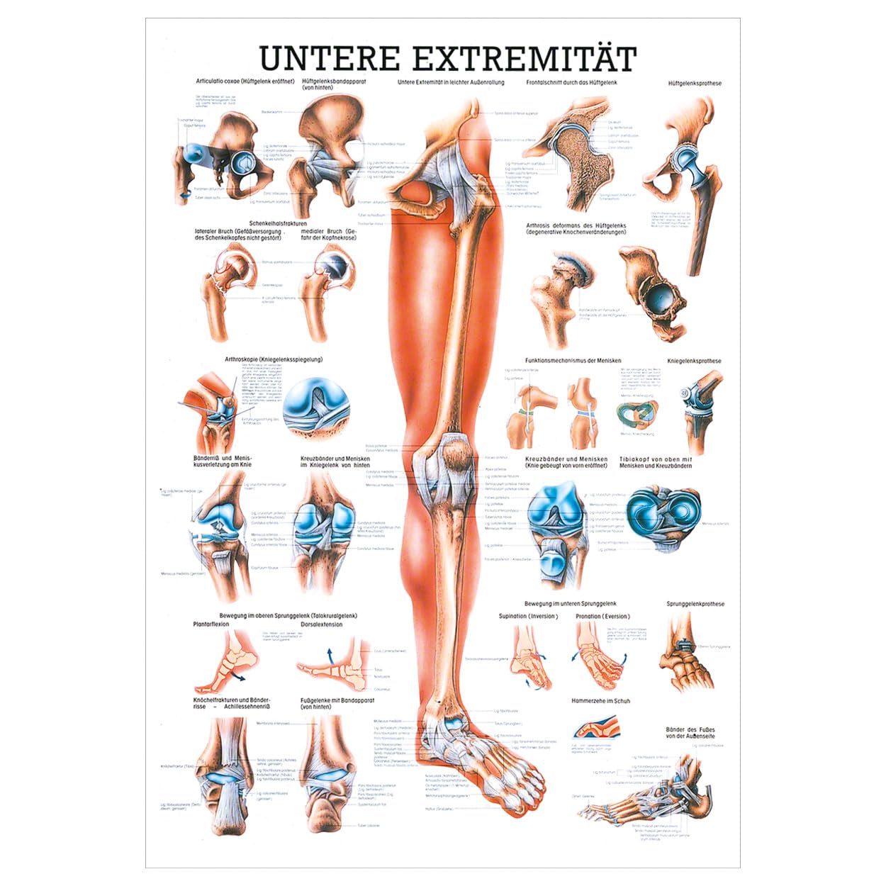Rüdiger Untere Extremität Lehrtafel Anatomie 100x70 cm medizinische Lehrmittel