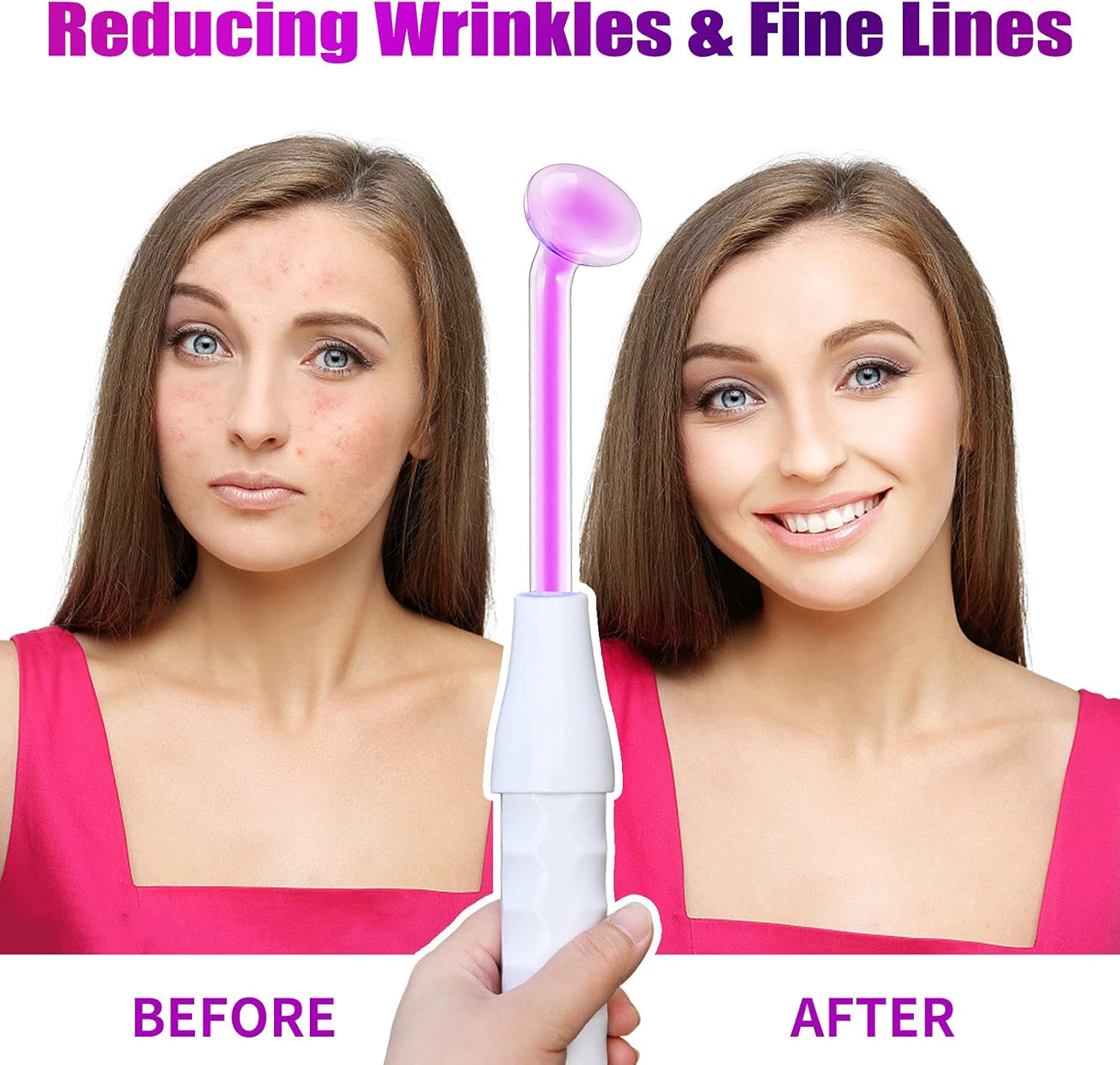 High Frequency Facial Machine, SFENNGPET Portable High Frequency Wand Facial Machine for Eyes Body Care Spa Salon Home : Beauty & Personal Care