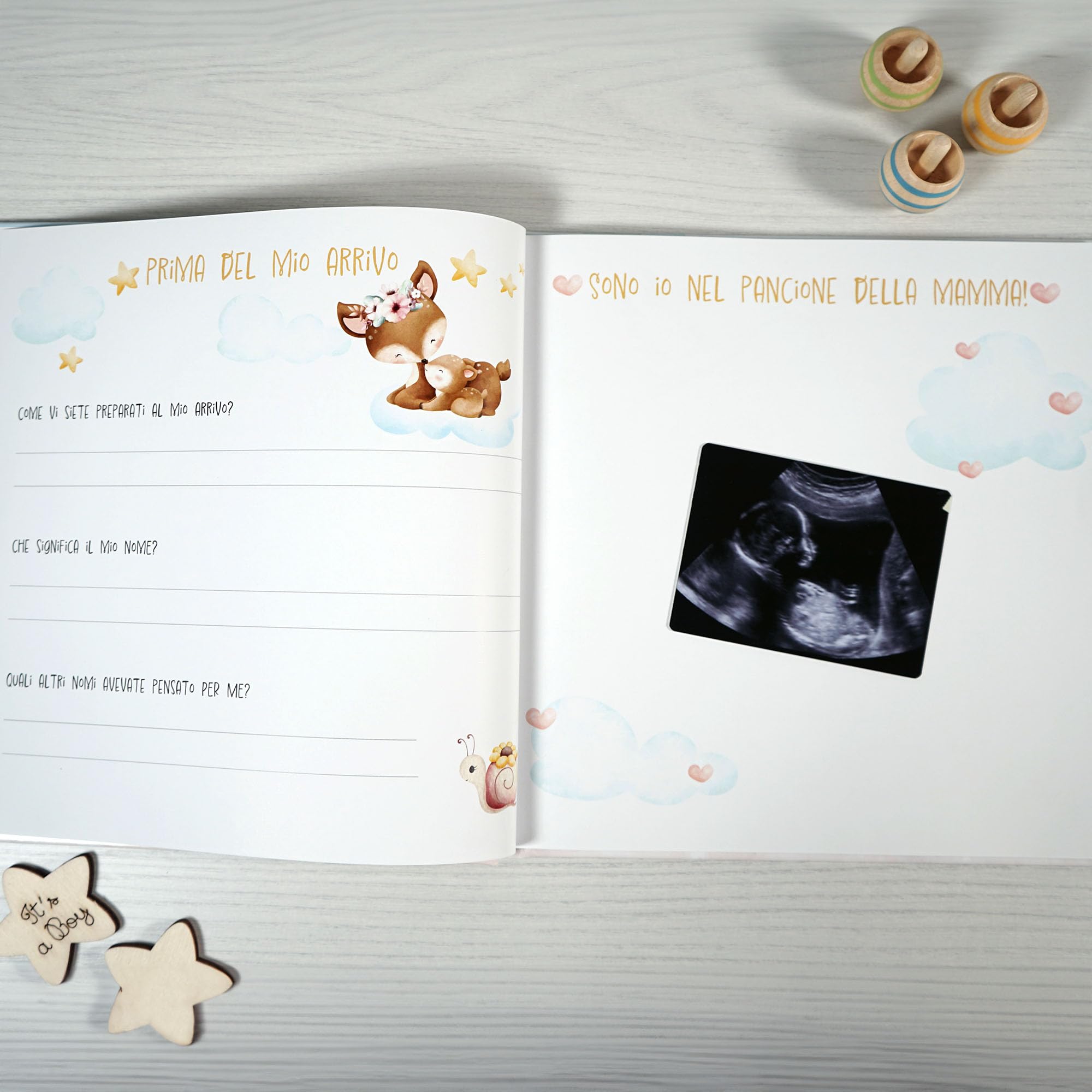 Album primo anno bambino, Libro nascita con copertina personalizzabile, Album dei ricordi, Album primo anno del bambino da compilare, Diario bebè da compilare (Italiano)