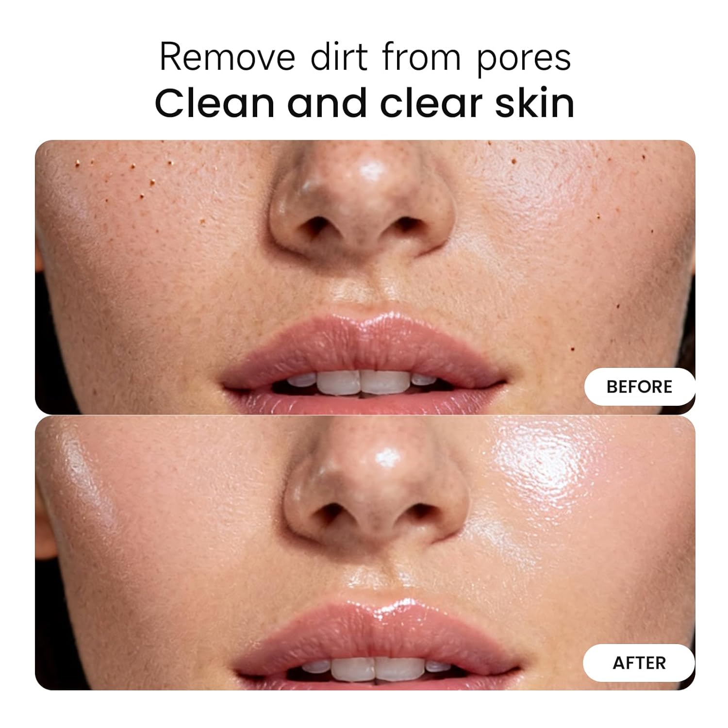 Keratin Care Turmeric Exfoliating spray With Kojic Acid & Turmeric, Gently Exfoliating & Brightening, Peeling Solution For All Skin Types,Carbonated Water Micro-Foam Technology Spray 200ml - Image 4