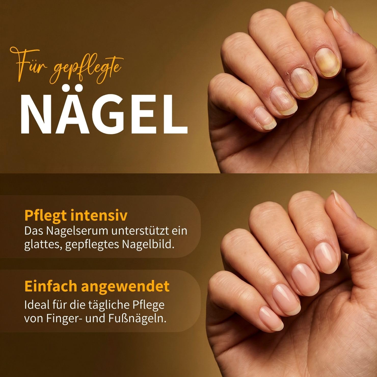 bedrop Propolis Nagelserum - hochdosierte Pflege der Haut bei Nagelproblemen I Nail Care Formel mit Teebaumöl I Schnelle & Intensive Wirkung - 10ml