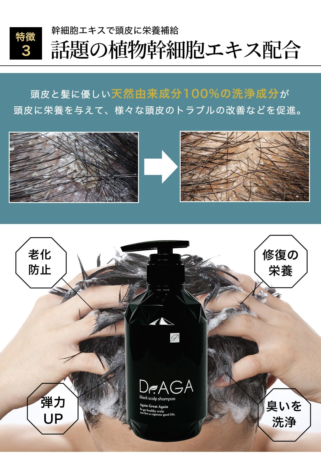 Dr.AGAクリニック　シャンプー3本　トリートメント3本 Dシャンプー＆トリートメント 300ml 3本×3本（6本）セット - メルカリ