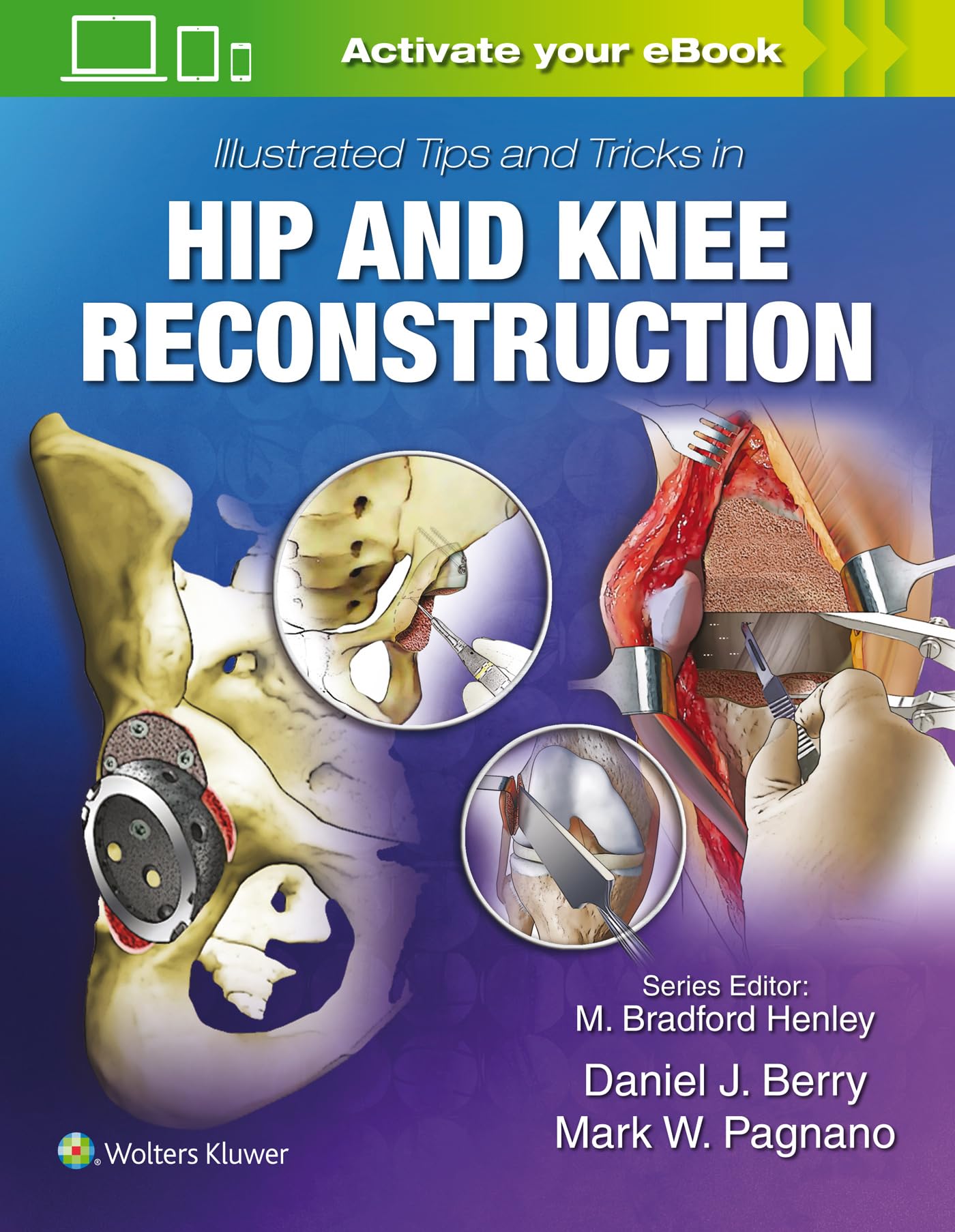 Illustrated Tips and Tricks in Hip and Knee Reconstructive and Replacement Surgery product thumbnail 2