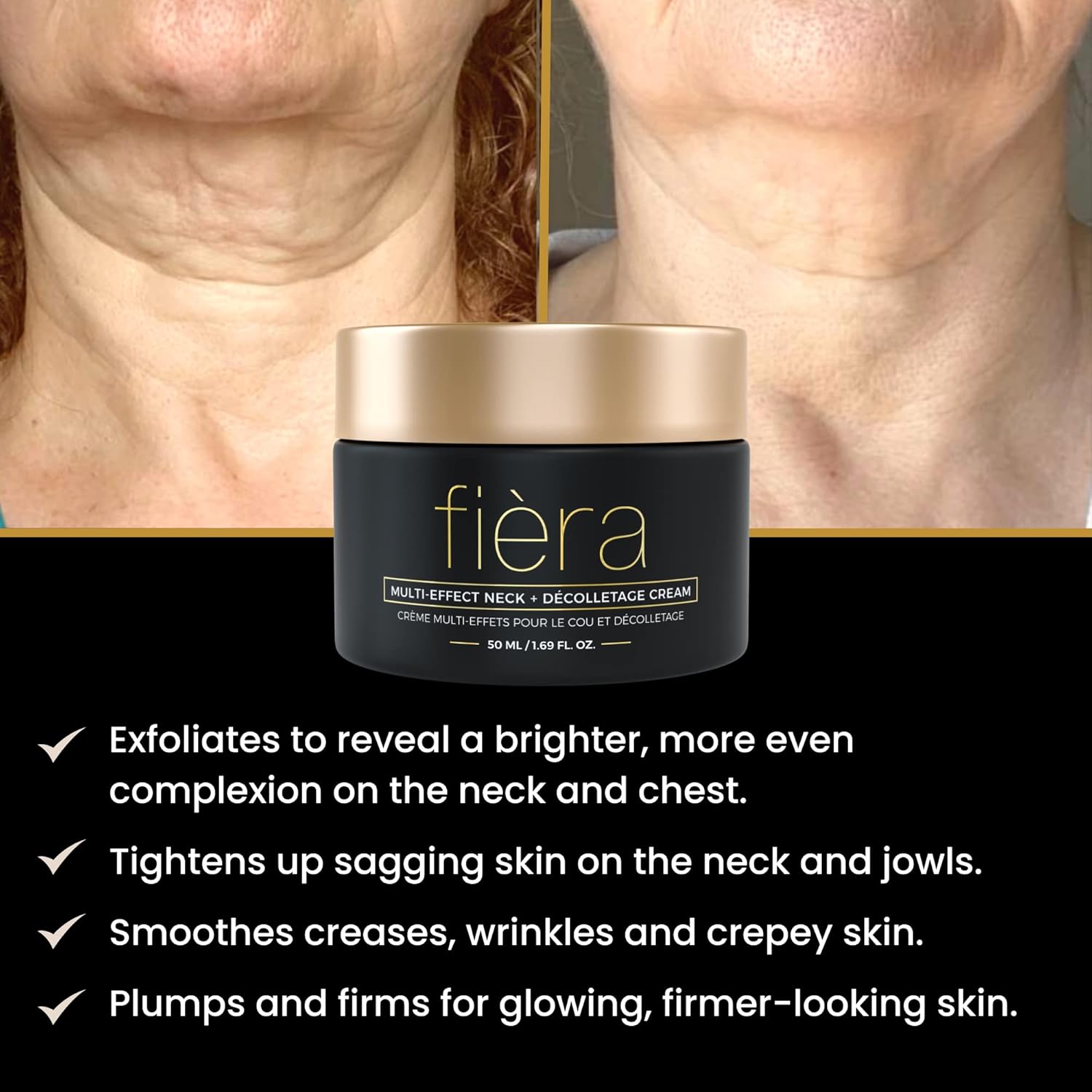 FIÈRA Neck Firming & Tightening Cream - Anti Aging Moisturizer for Neck - With Glycolic & Hyaluronic Acid, Squalane, Willow Bark Extract - 50 ML / 1.69 FL. OZ. : Beauty & Personal Care