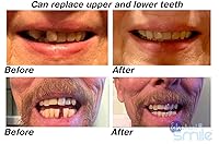 Vista 3 de Instant Smile Kit de reparación de dientes temporal patentado MULTISHADE. Una solución de aspecto realista para un diente perdido o roto.
