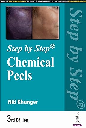 STEP BY STEP CHEMICAL PEELS