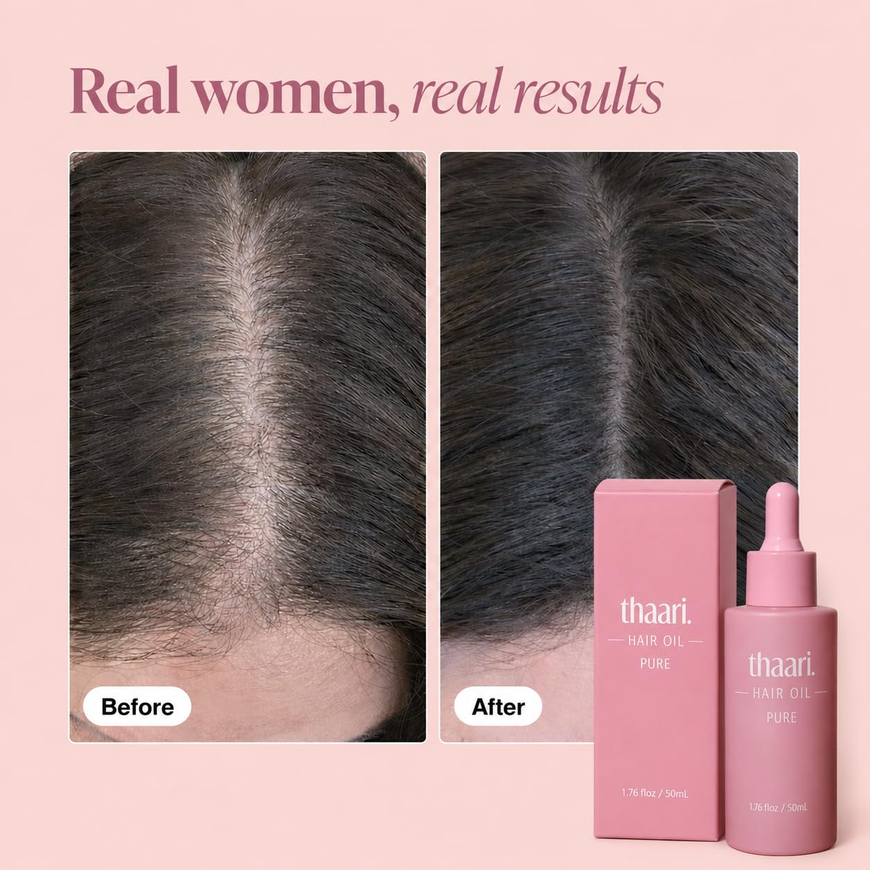 Hair Growth Oil, Nourishing Hair Growth Serum, Helps Smooth and Reduce Breakage, 1.76 fl oz (50 ml)
